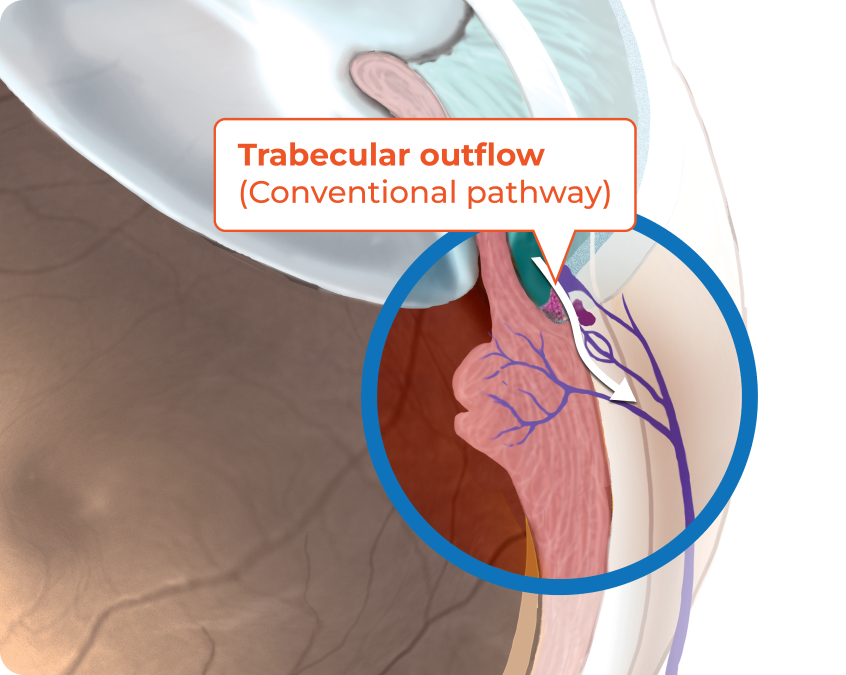 Trabecular outflow (Conventional pathway) graphic